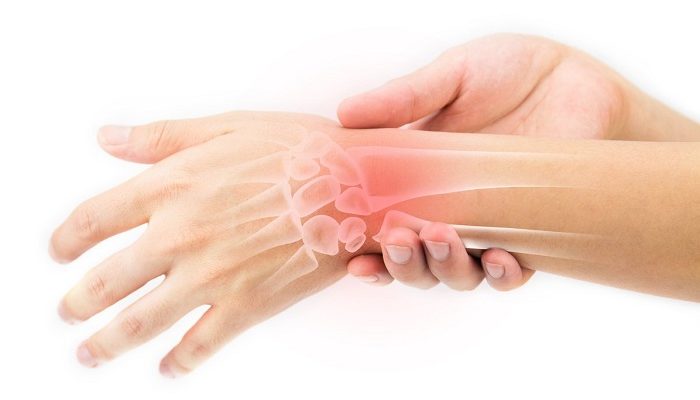 Sedam načina za prirodno ublažavanje boli u zglobovima