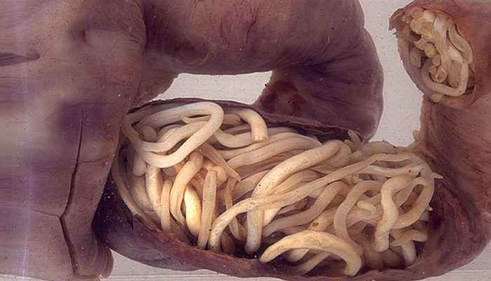 Crijevni parazita kód ljudi lecenje. Giardia parazita